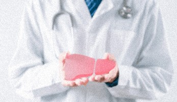 Čo zaťažuje pečeň: príznaky, riziká a kedy si dať skontrolovať pečeňové testy
